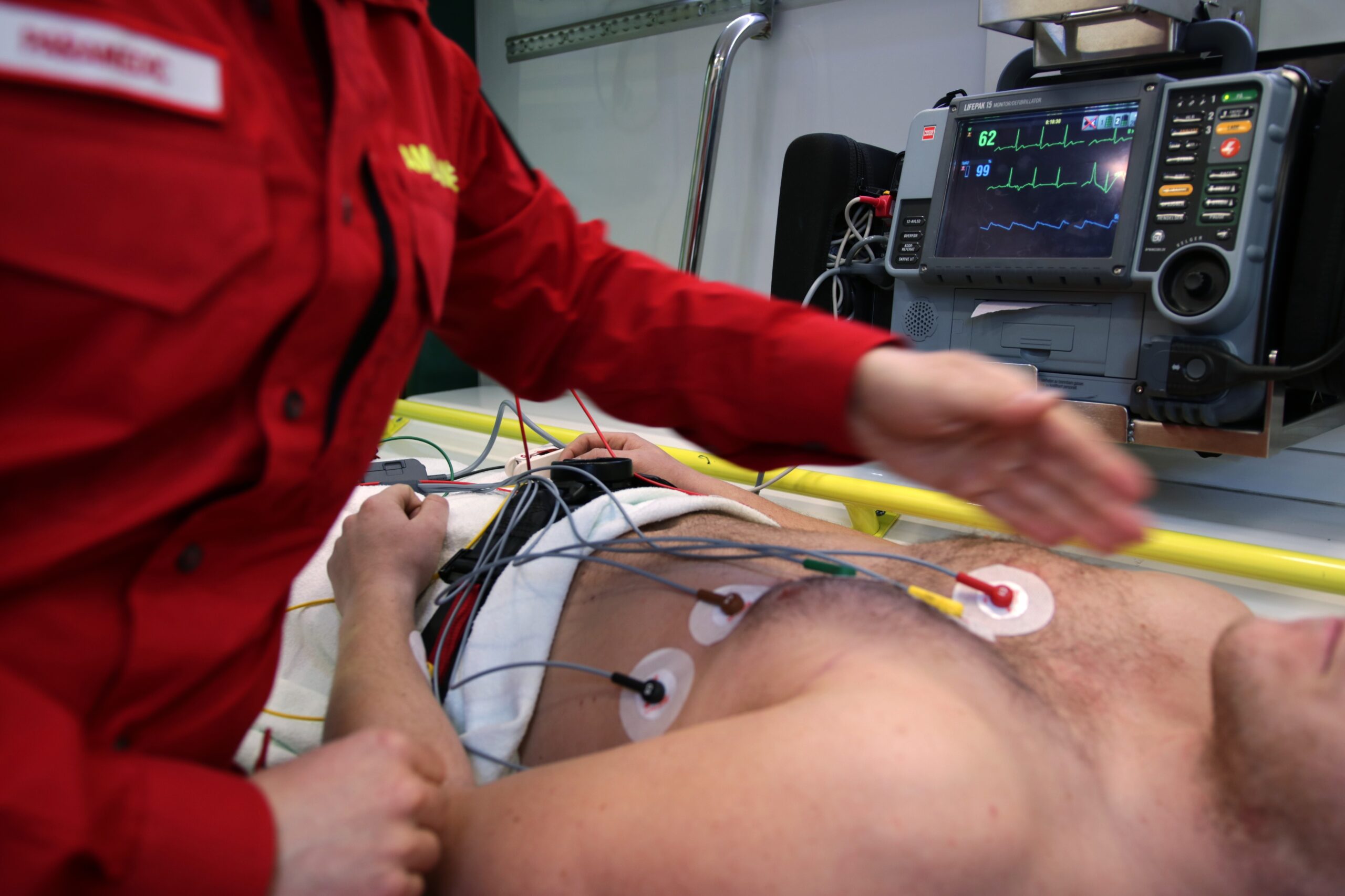 AI Tool Shows Promise in Detecting Hidden Heart Dysfunction